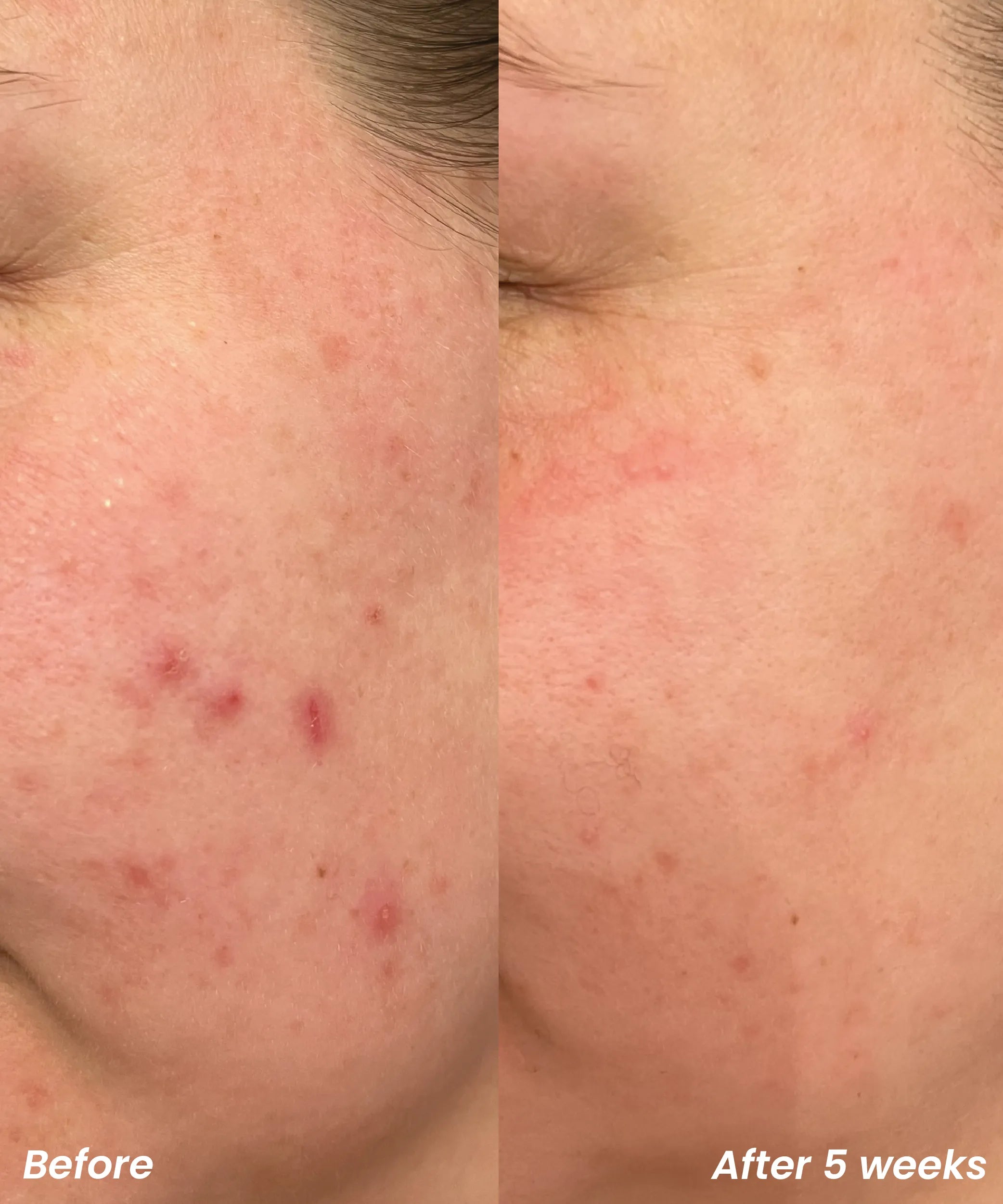 BHA/AHA Exfoliant | Clay And Glow